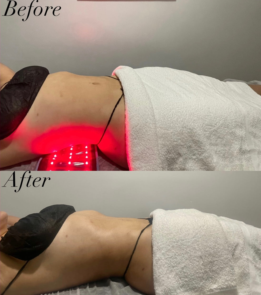 FULL BODY WOOD THERAPY 10 SESSIONS